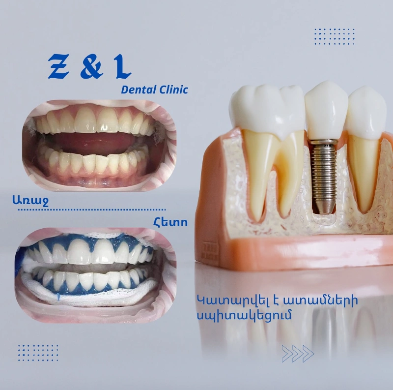 Z & L DENTAL CLINIC work